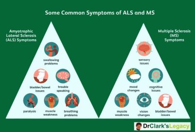 Multiple Sclerosis & Amyotropic Lateral Sclerosis - Dr. Clark's Legacy