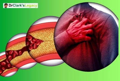 Muscle Diseases