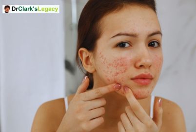 Skin Problems